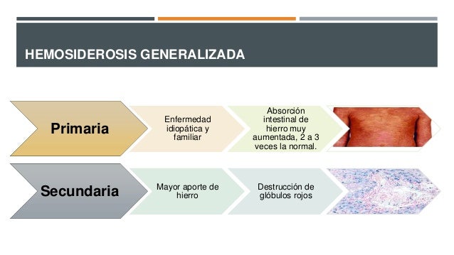 hemosiderosis secundaria